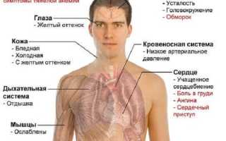 Заболевание анемия