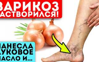 Лук при варикозе