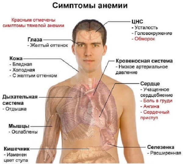 описание заболевания анемия