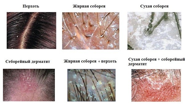 виды себореи